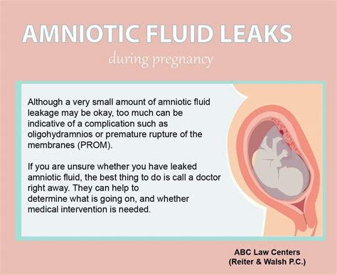 small amount of amniotic fluid leak|Leaking amniotic fluid: Signs and what to do